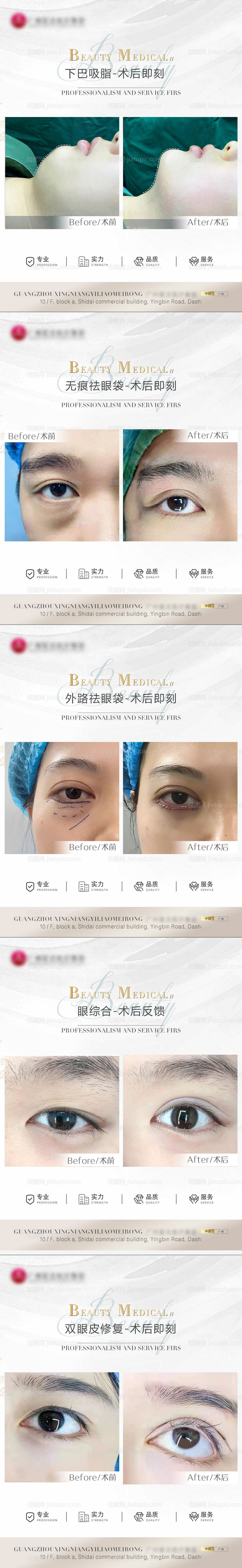 医美案例模板系列海报-源文件