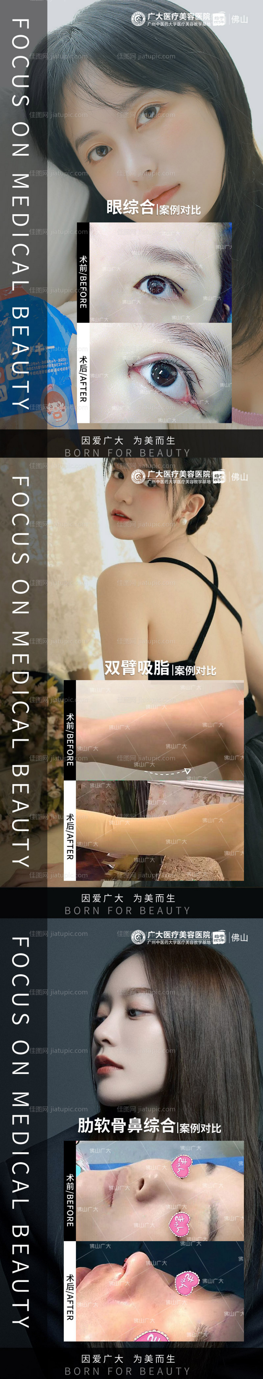 整形真人案例分享集-源文件