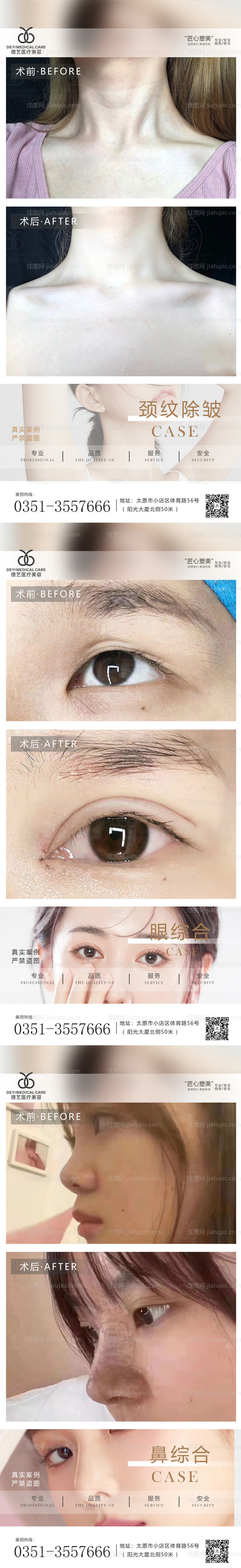 医美案例对比图-源文件