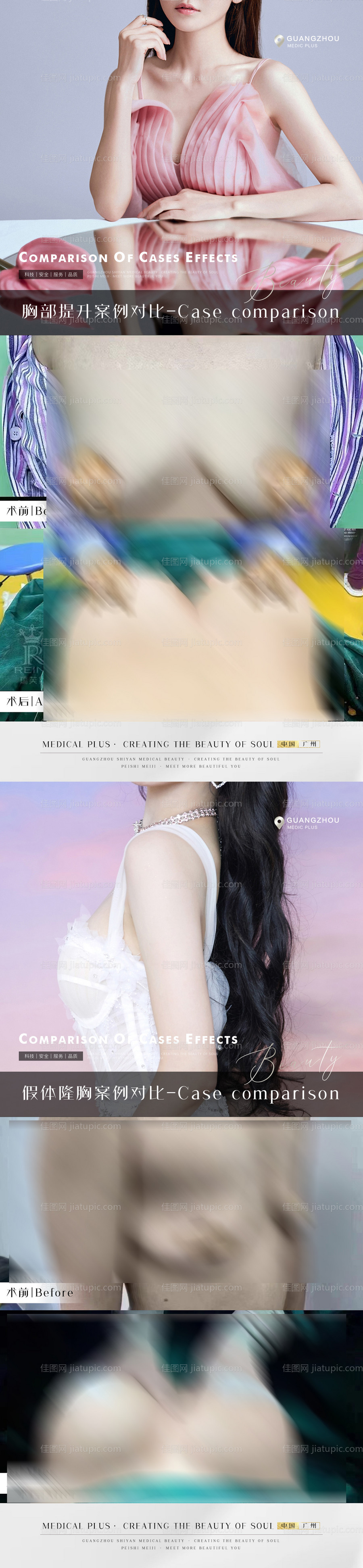 整形真人案例分享集系列海报-源文件