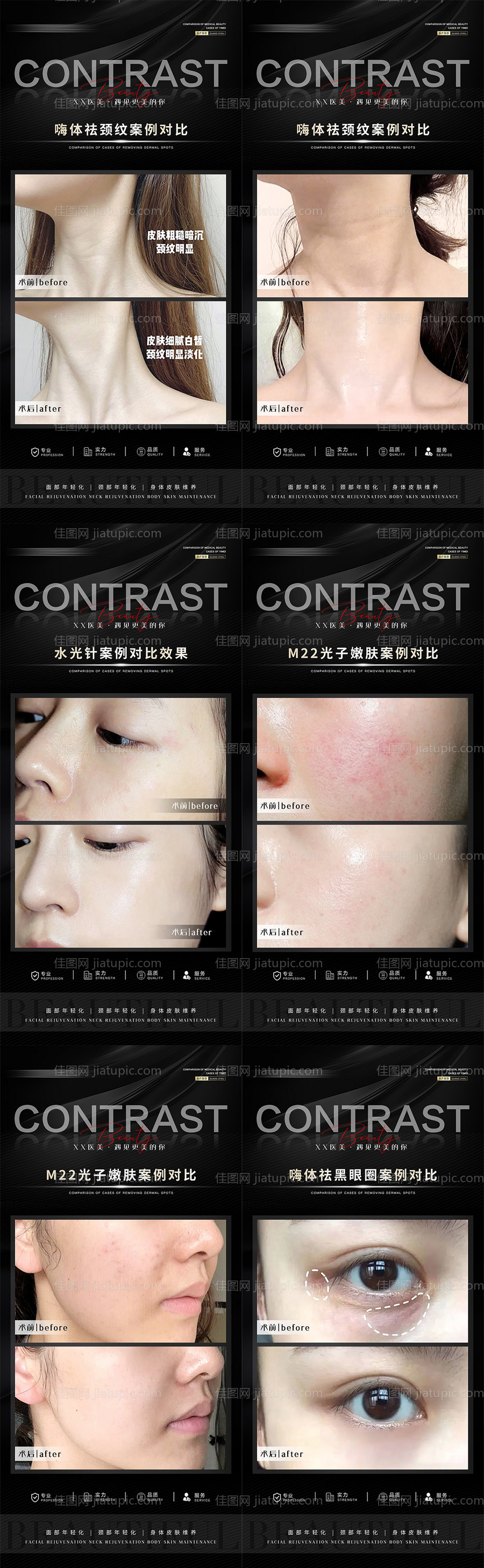 医美案例海报-源文件