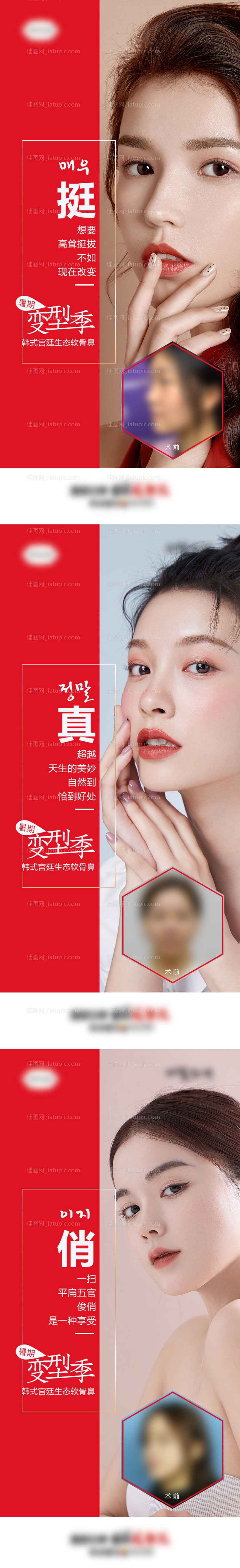 医美整形隆鼻暑期变型记前后对比案例海-源文件