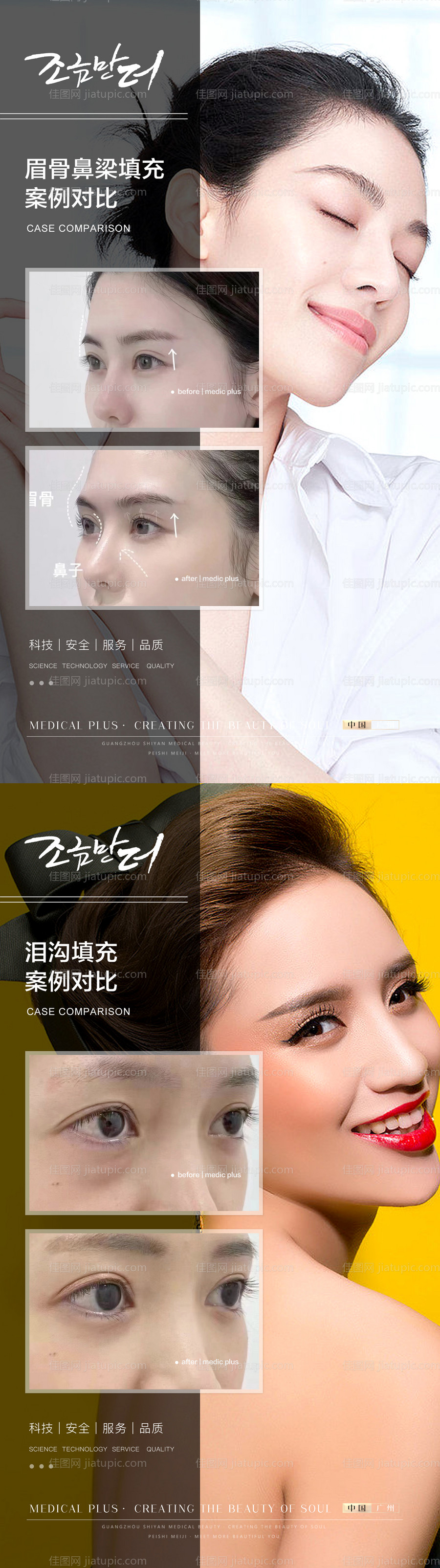 整形真人案例分享集系列海报-源文件