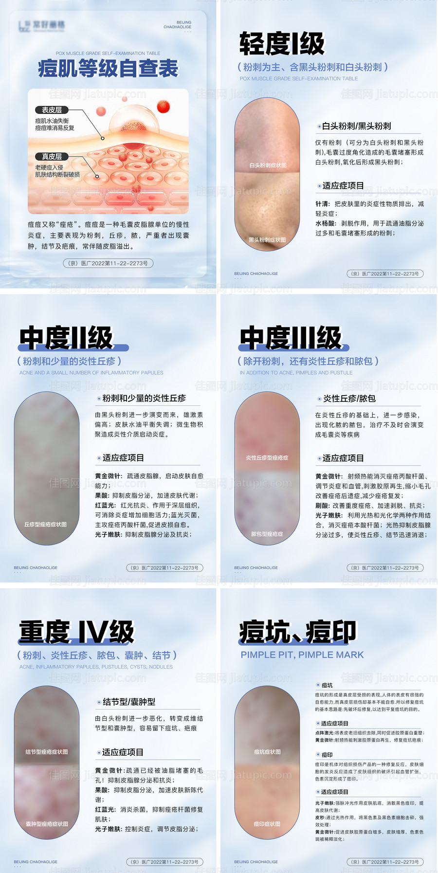 医美痘肌痘痘痘印科普系列海报展板-源文件