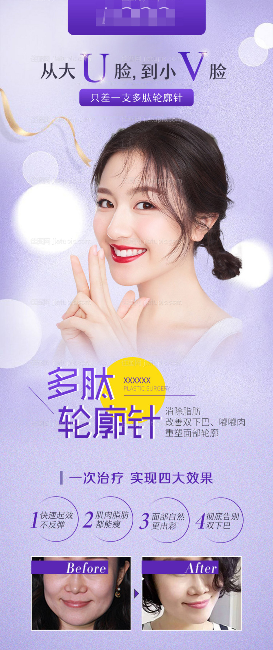 医美整形瘦脸轮廓针海报-源文件