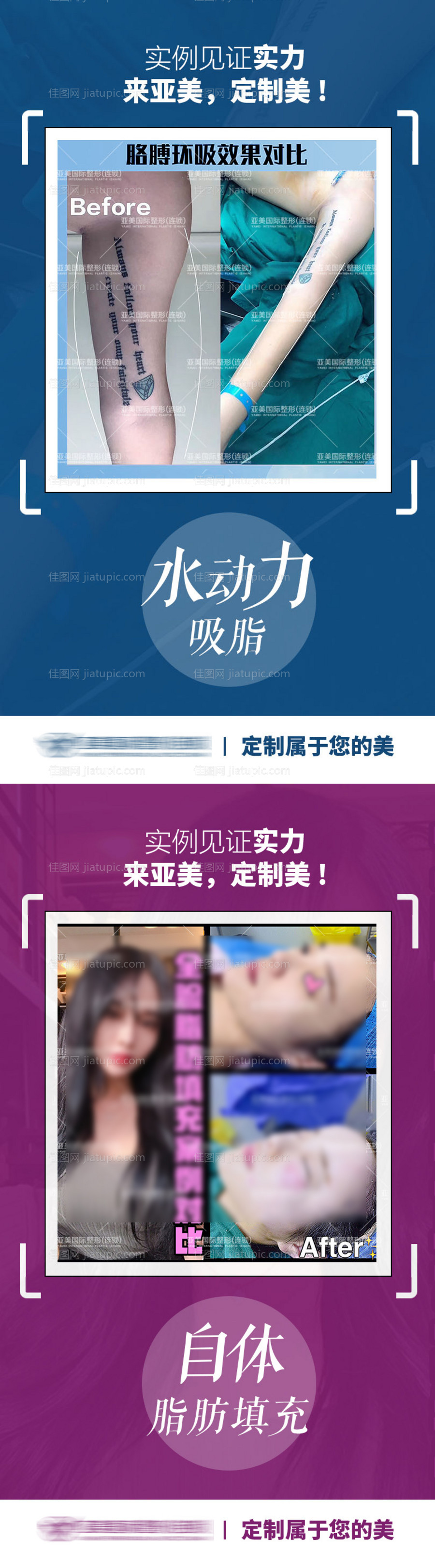 整形真人案例分享集-源文件