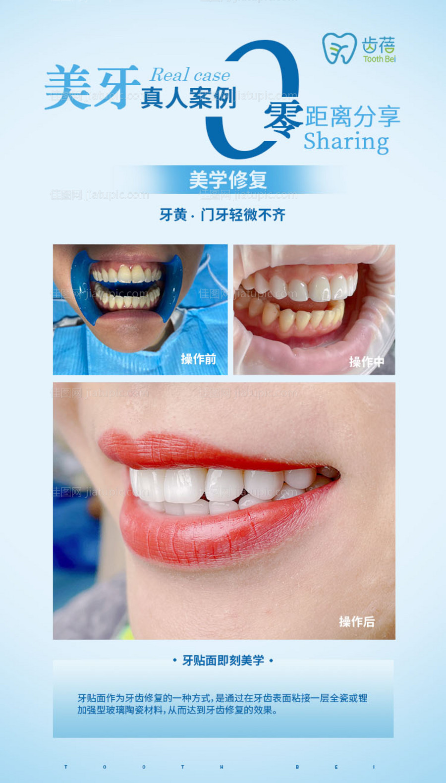 美业医美 -源文件