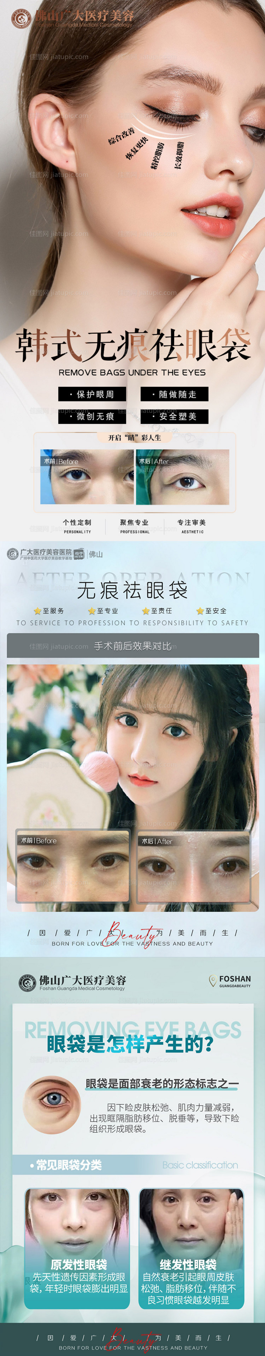 医美祛眼袋案例科普海报-源文件