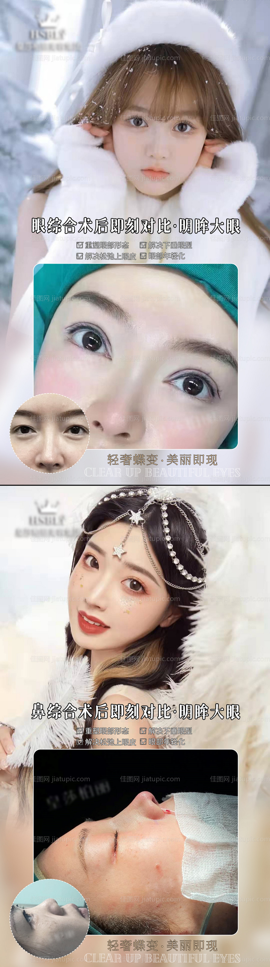 医美案例-源文件