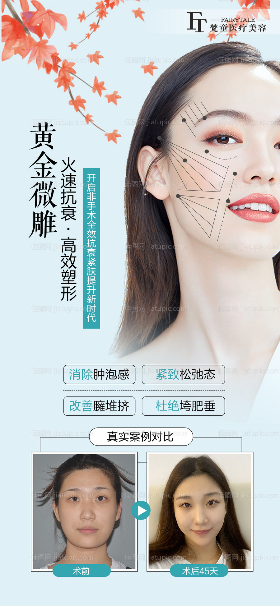 黄金微雕医美海报-源文件