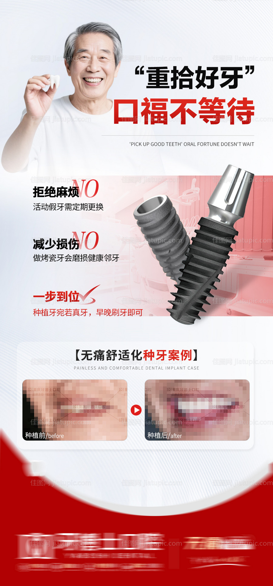 种牙海报-源文件