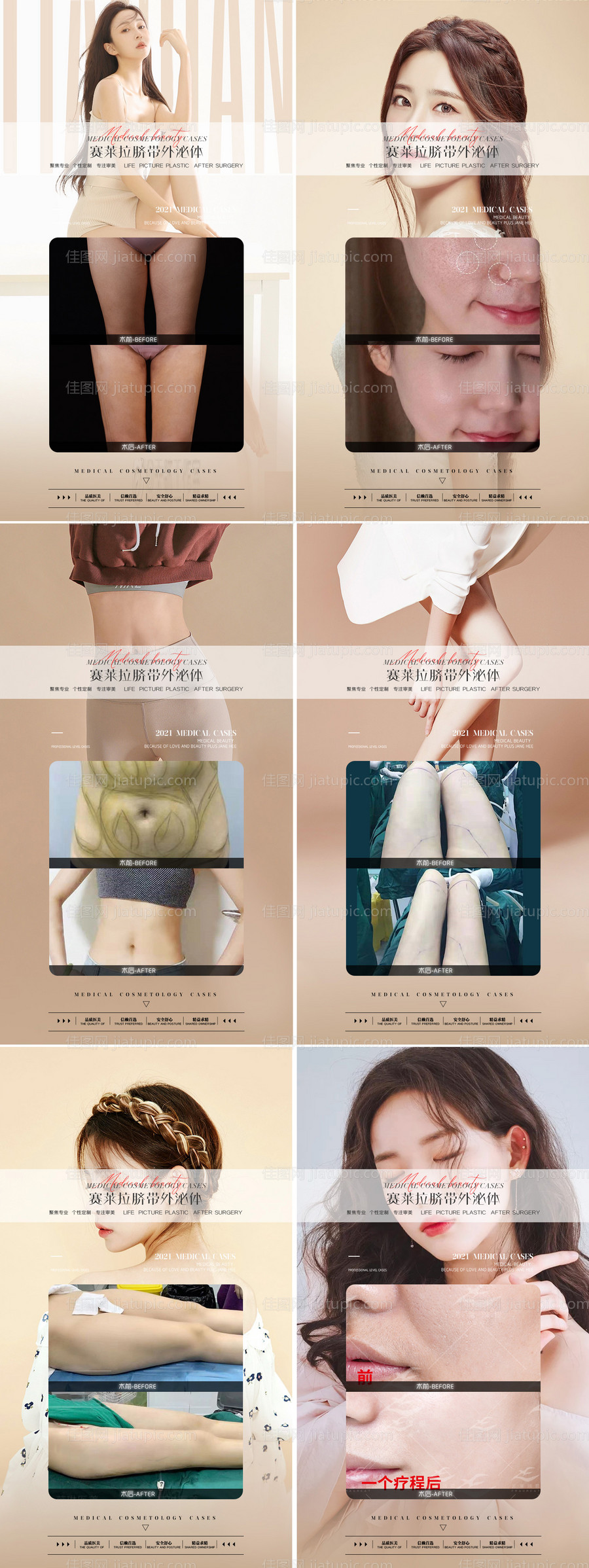 医美案例系列海报-源文件
