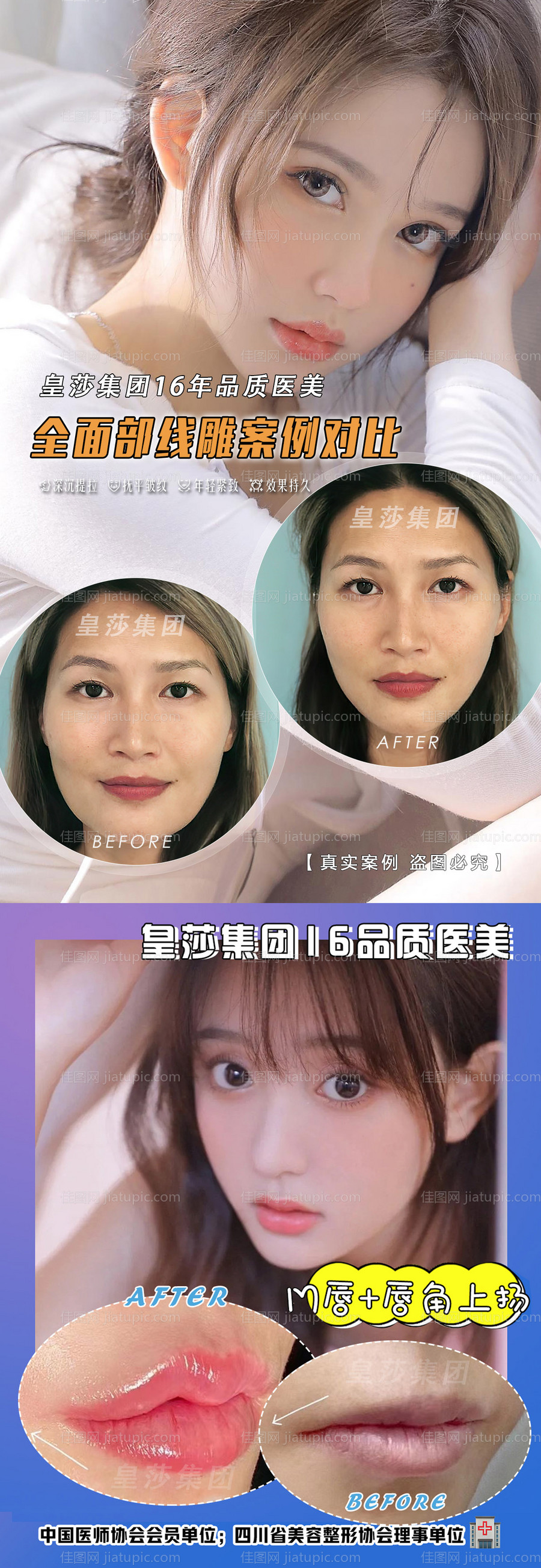 医美案例对比海报-源文件