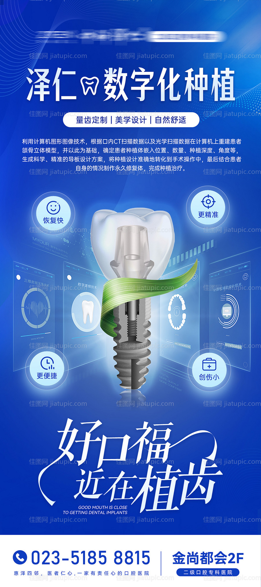 医美口腔种植牙项目介绍展架 -源文件