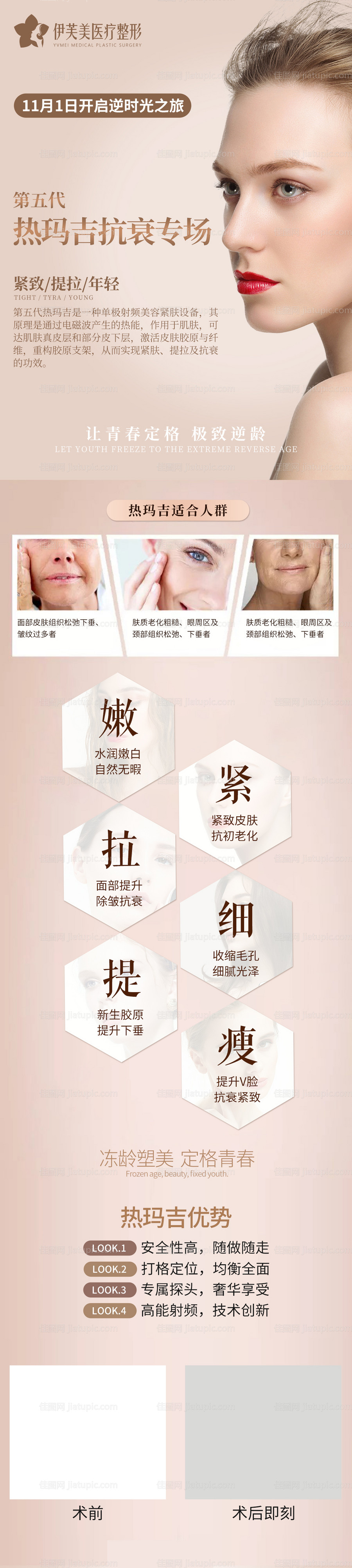 医美超声炮-源文件