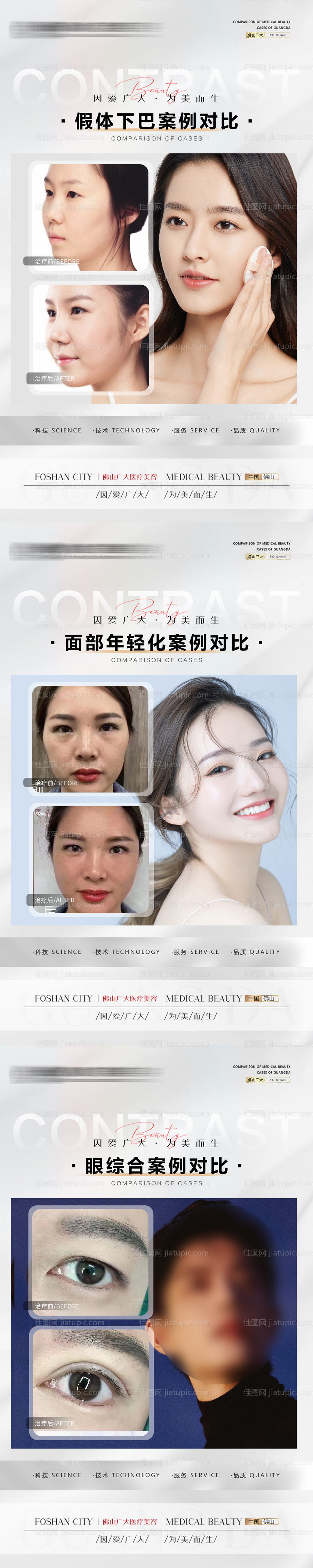 整形真人案例分享集-源文件