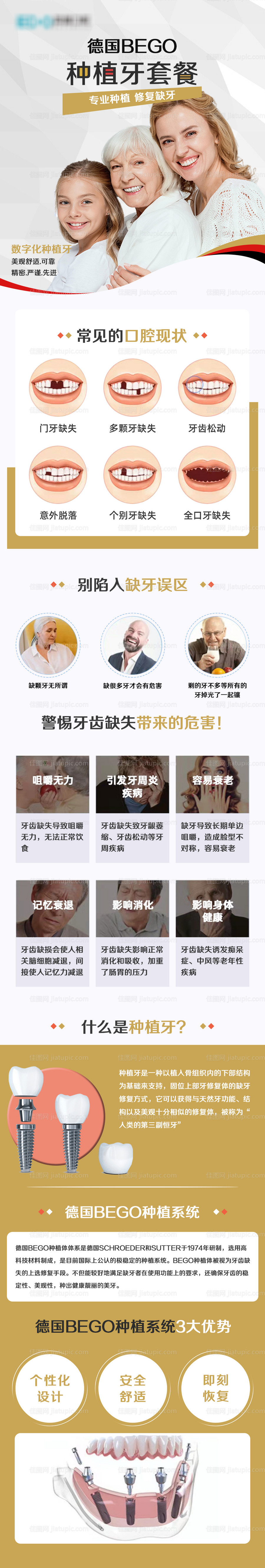 种植牙详情页-源文件