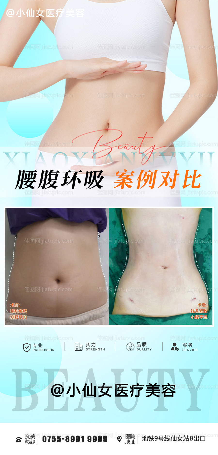 医美整形腰腹吸脂案例海报-源文件