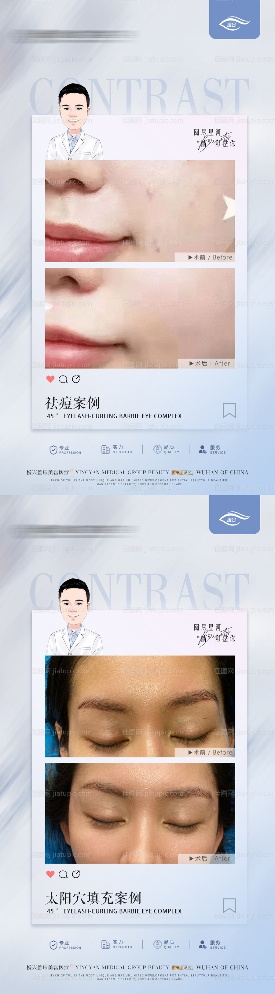 医美案例对比海报-源文件