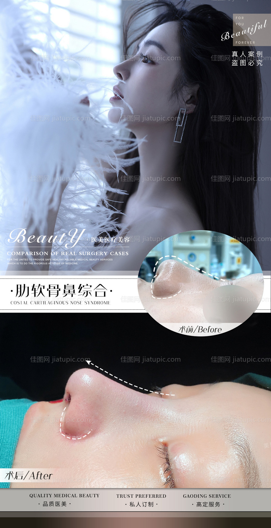 医美整形案例海报-源文件