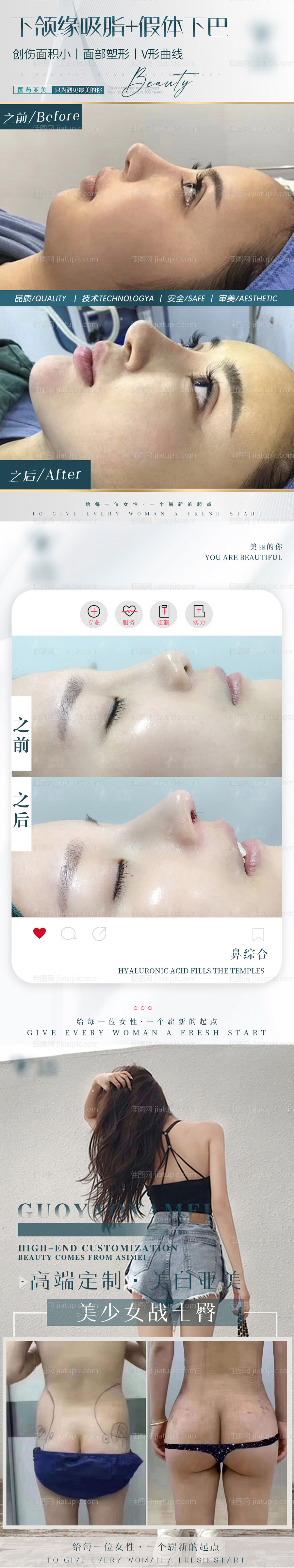 案例对比图-源文件