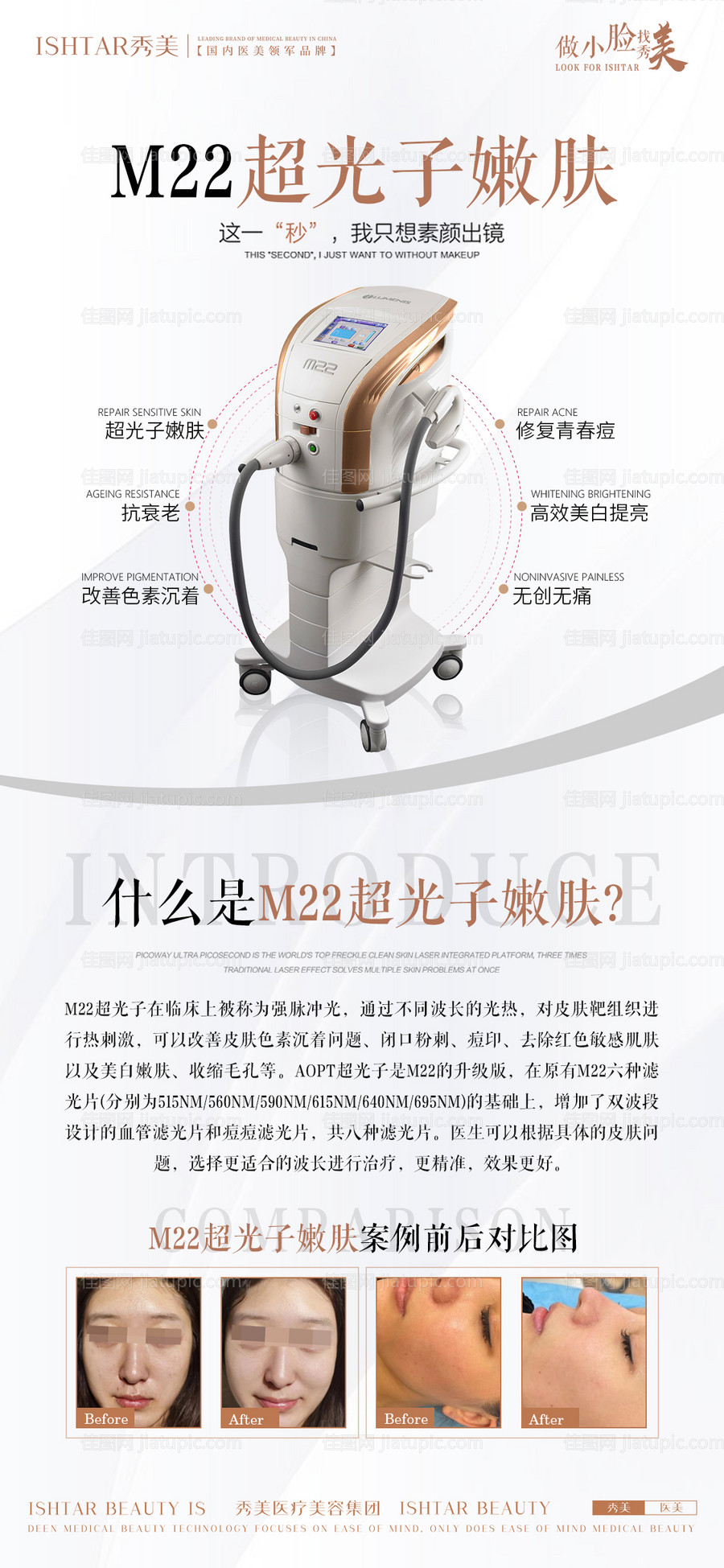 医美仪器介绍-源文件