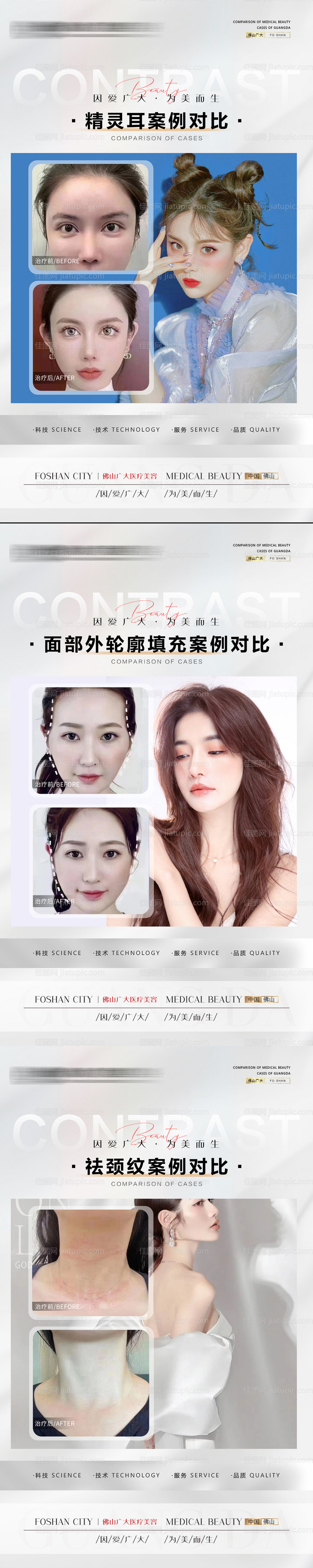 整形真人案例分享集-源文件