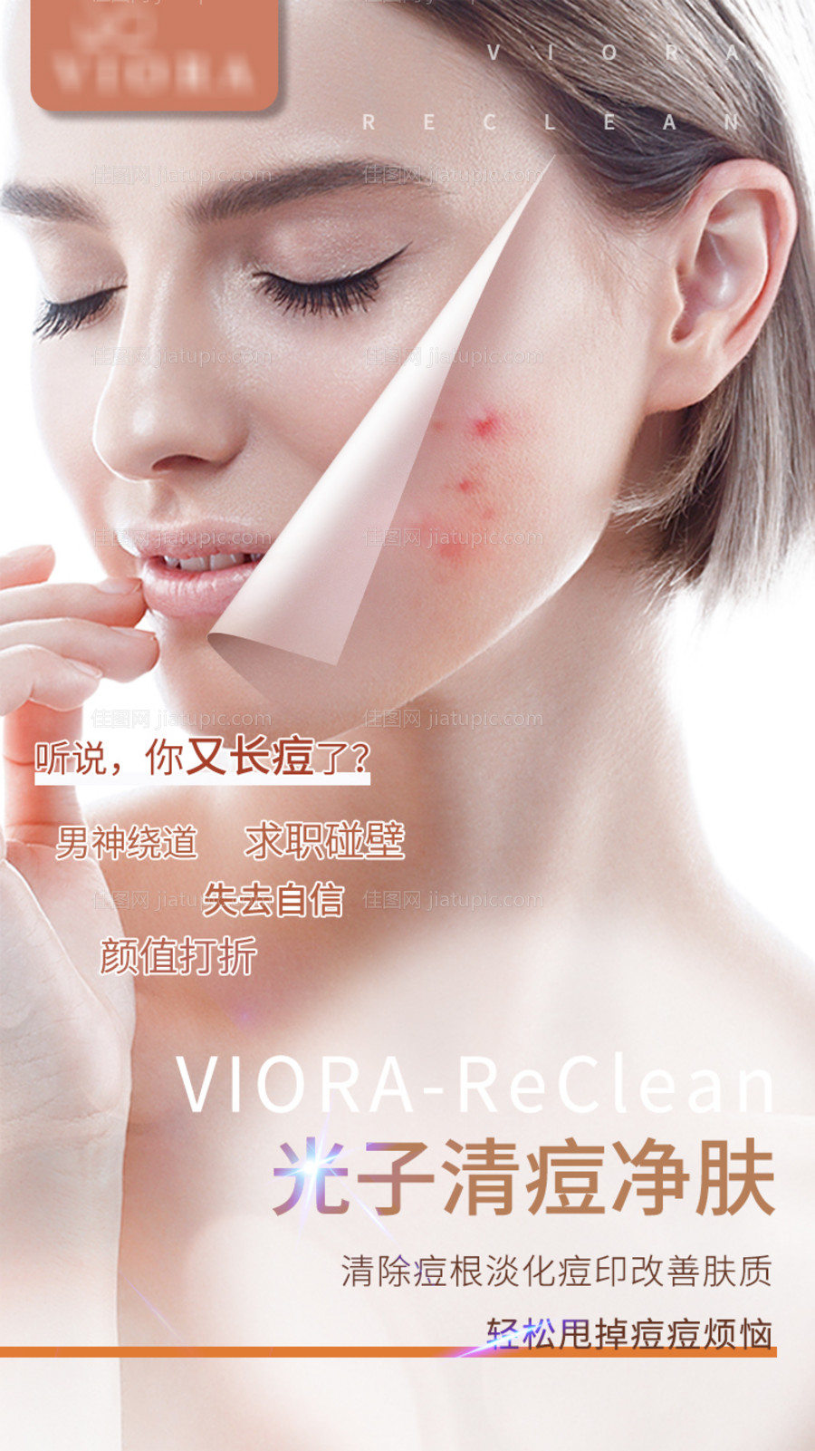 医美祛痘光子嫩肤海报-源文件