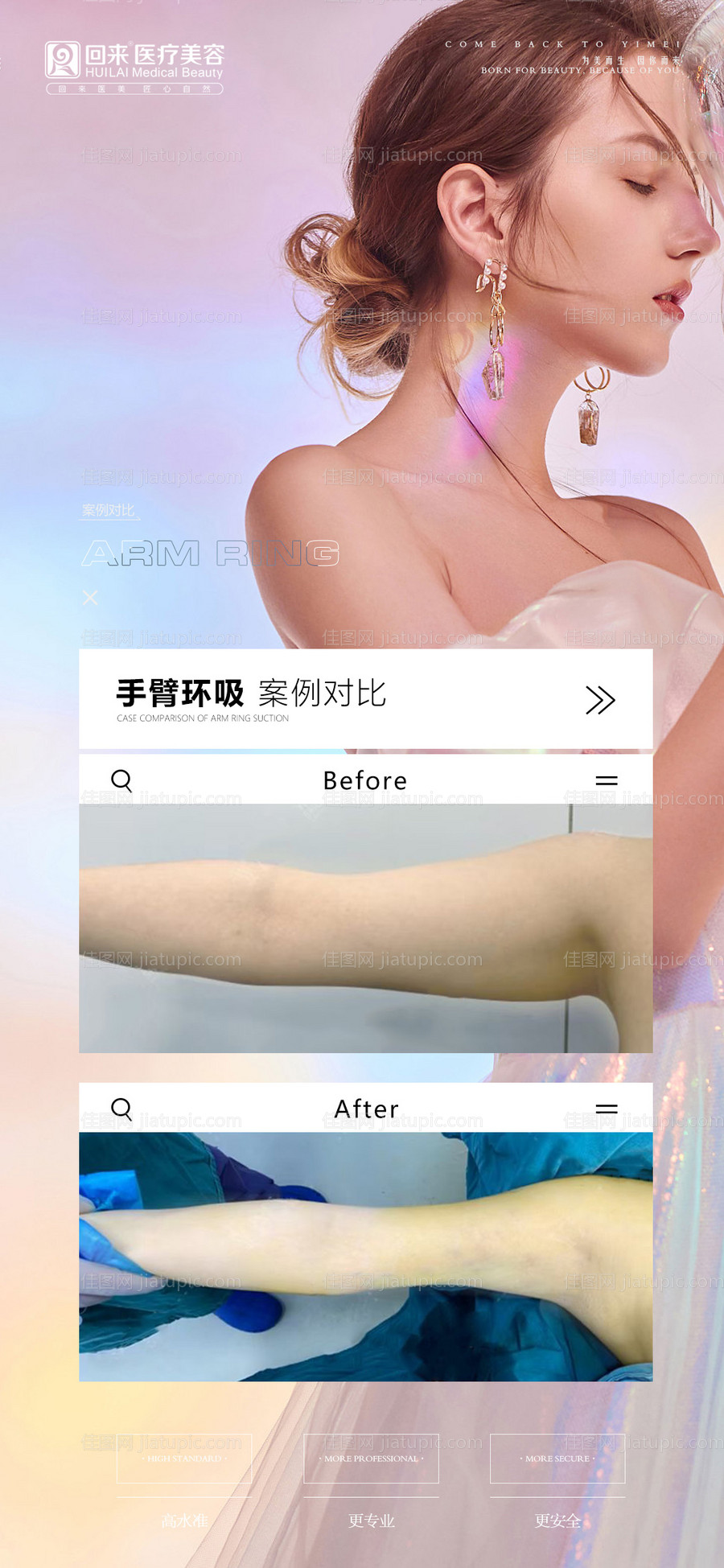 医美案例朋友圈宣传海报-源文件