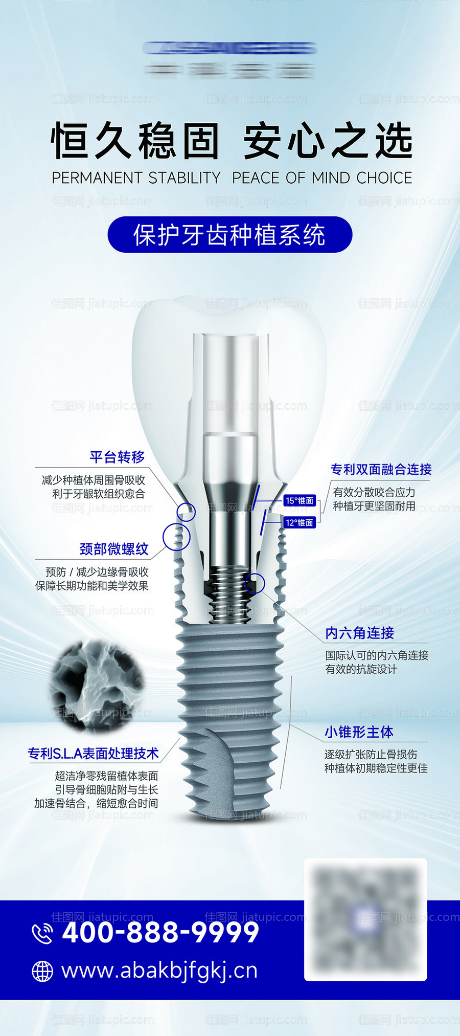 口腔种植牙植体介绍展架-源文件
