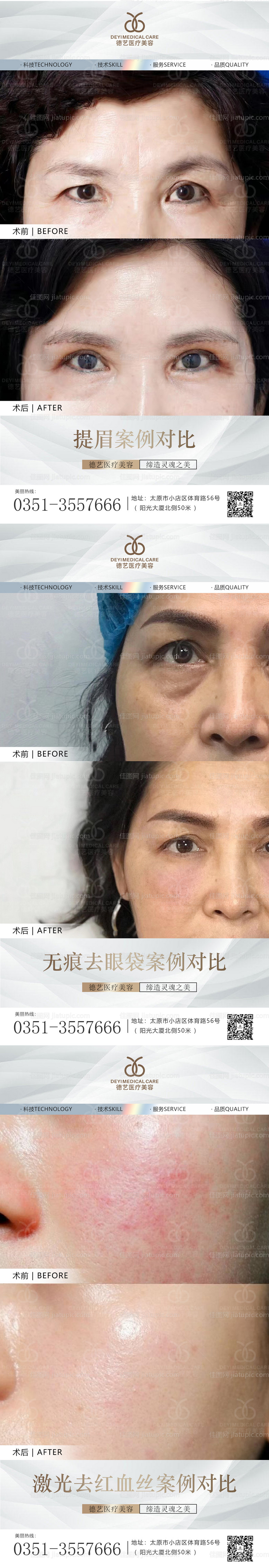 医美案例对比图-源文件