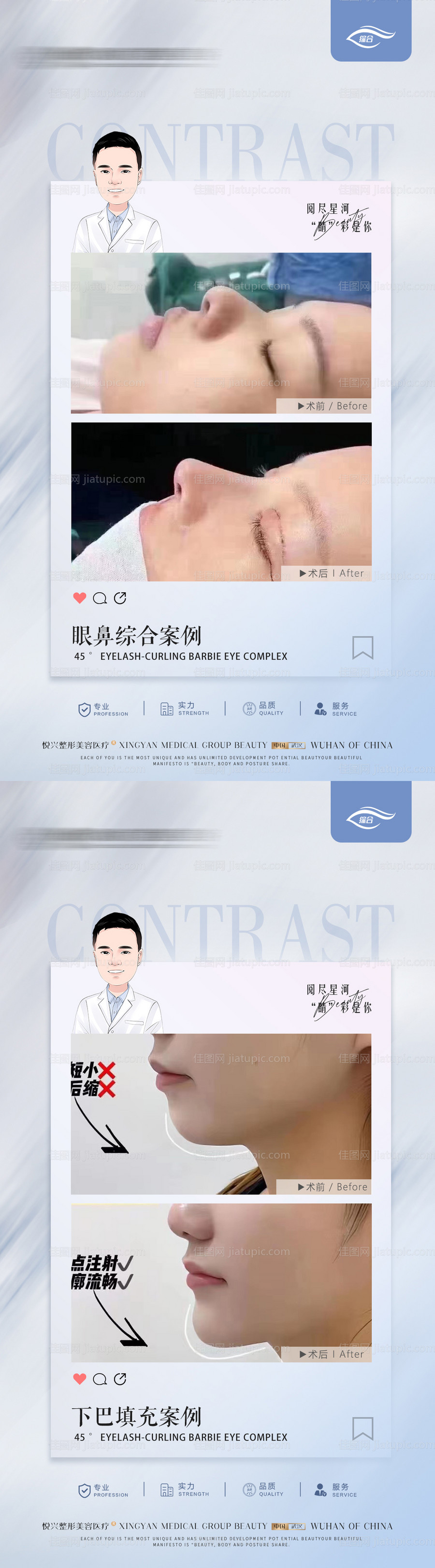 整形真人案例分享海报-源文件