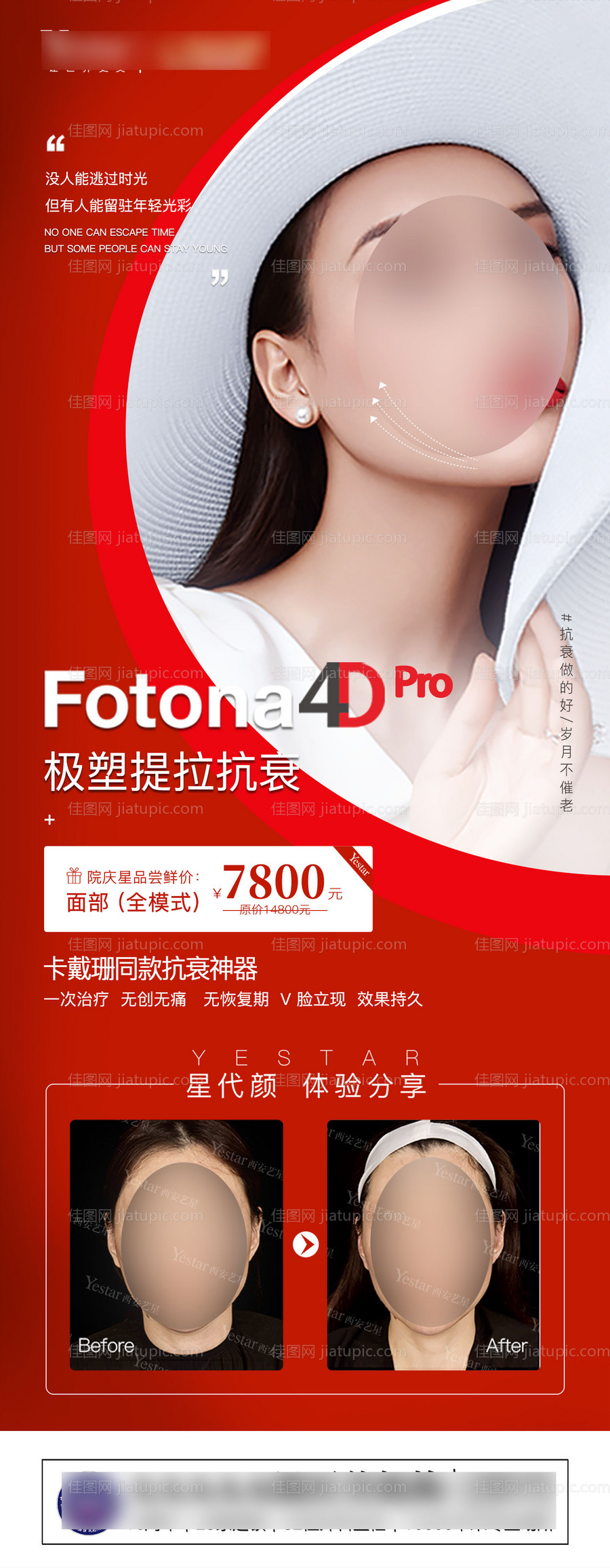 Fotona4D宣传图-源文件