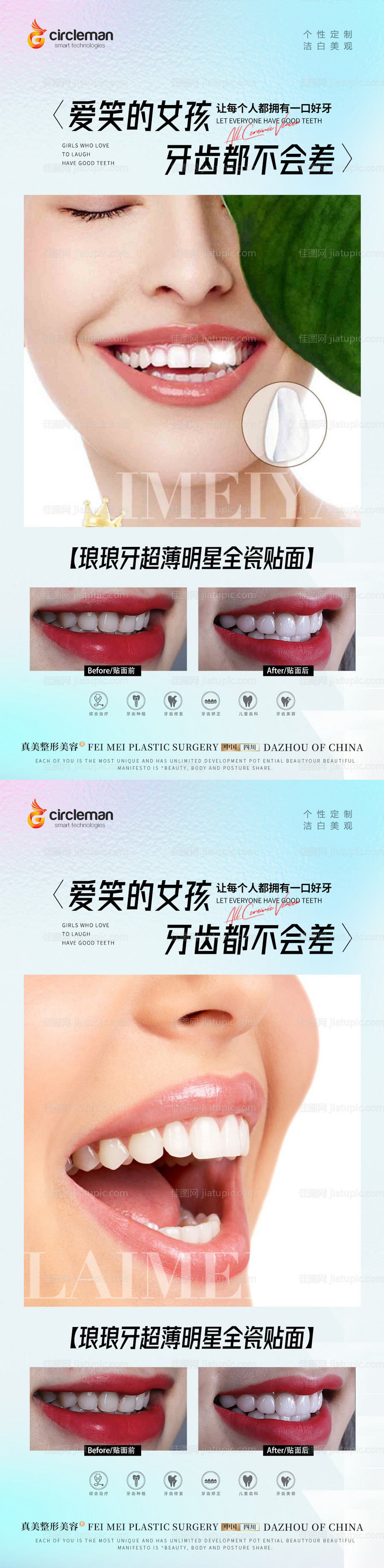 口腔瓷贴面海报-源文件