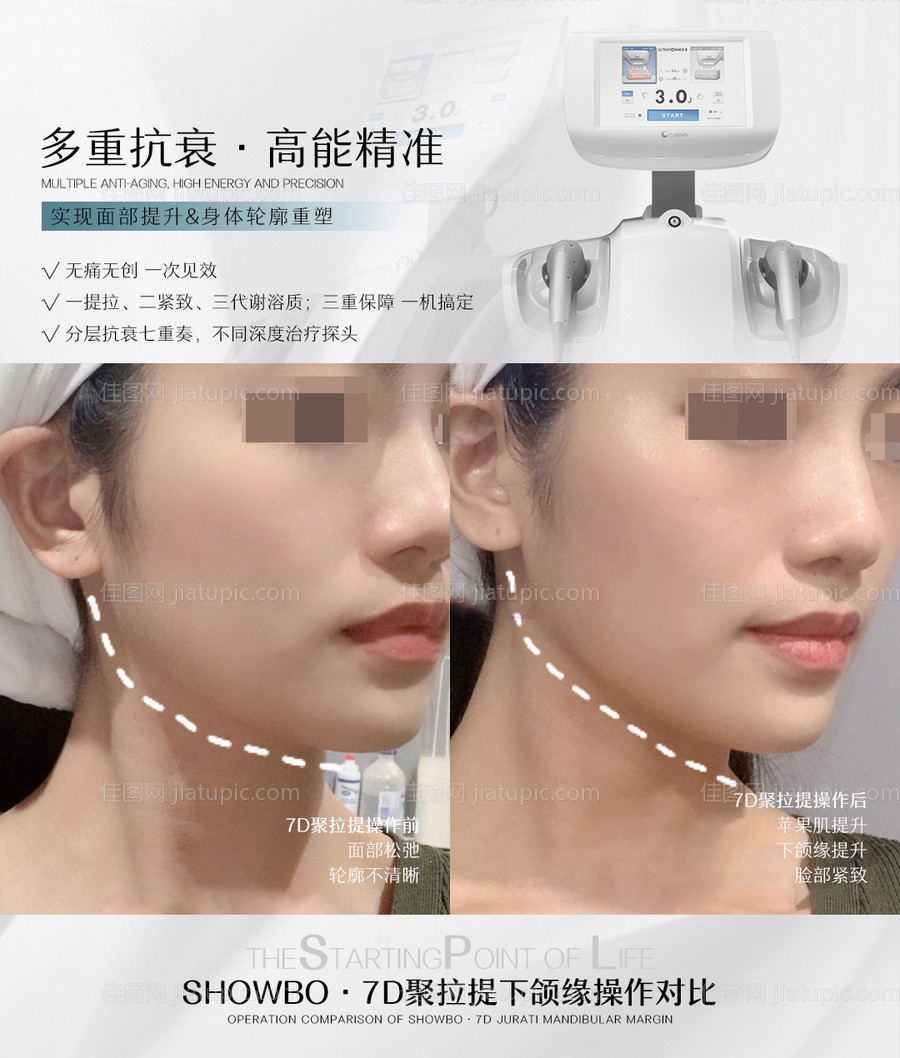 7D聚拉提对比图-源文件