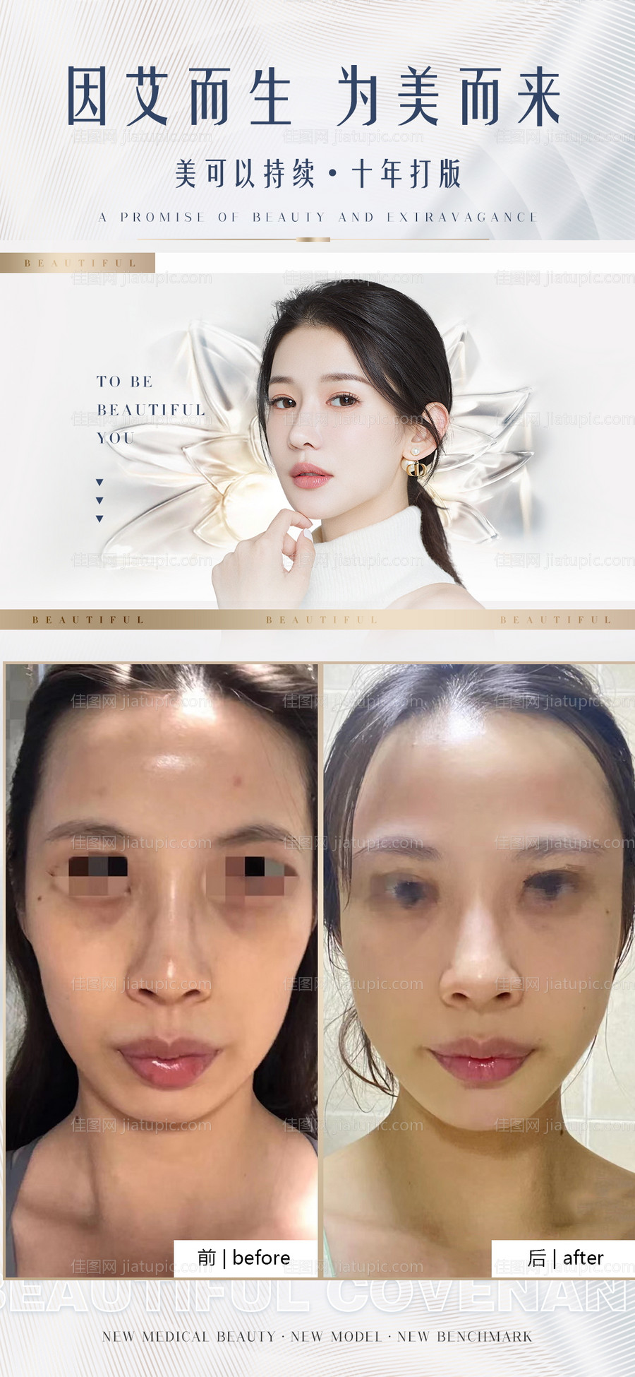 医美案例对比简约海报-源文件