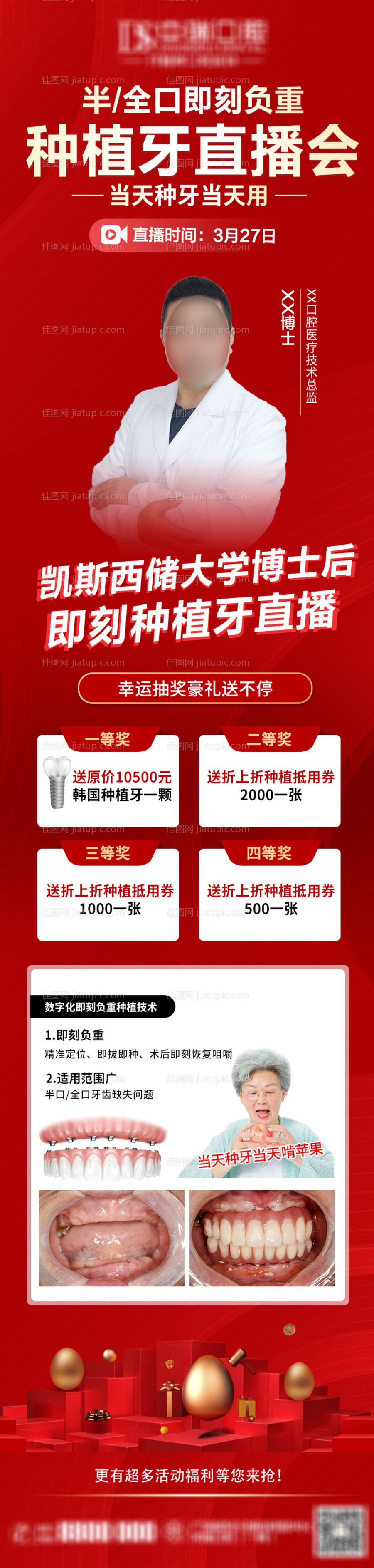 种植牙活动长图-源文件