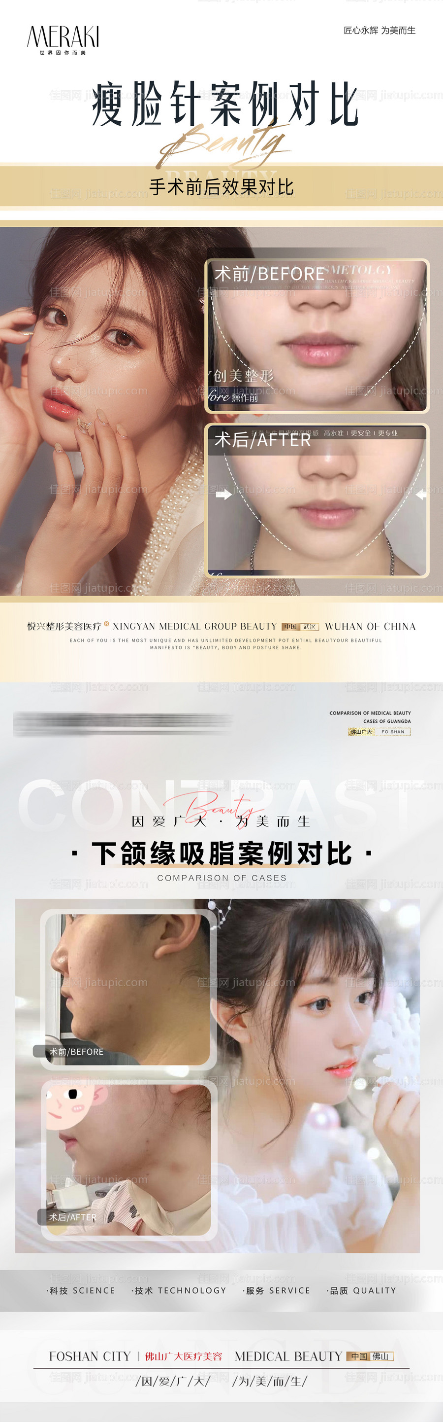 整形案例简约海报-源文件