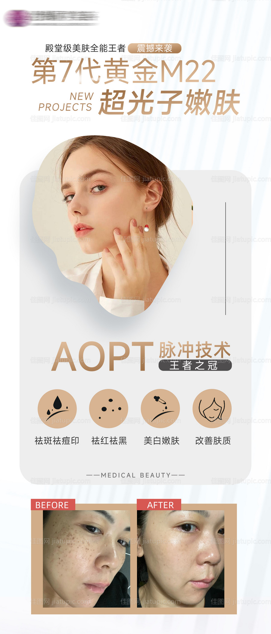 医美海报-源文件