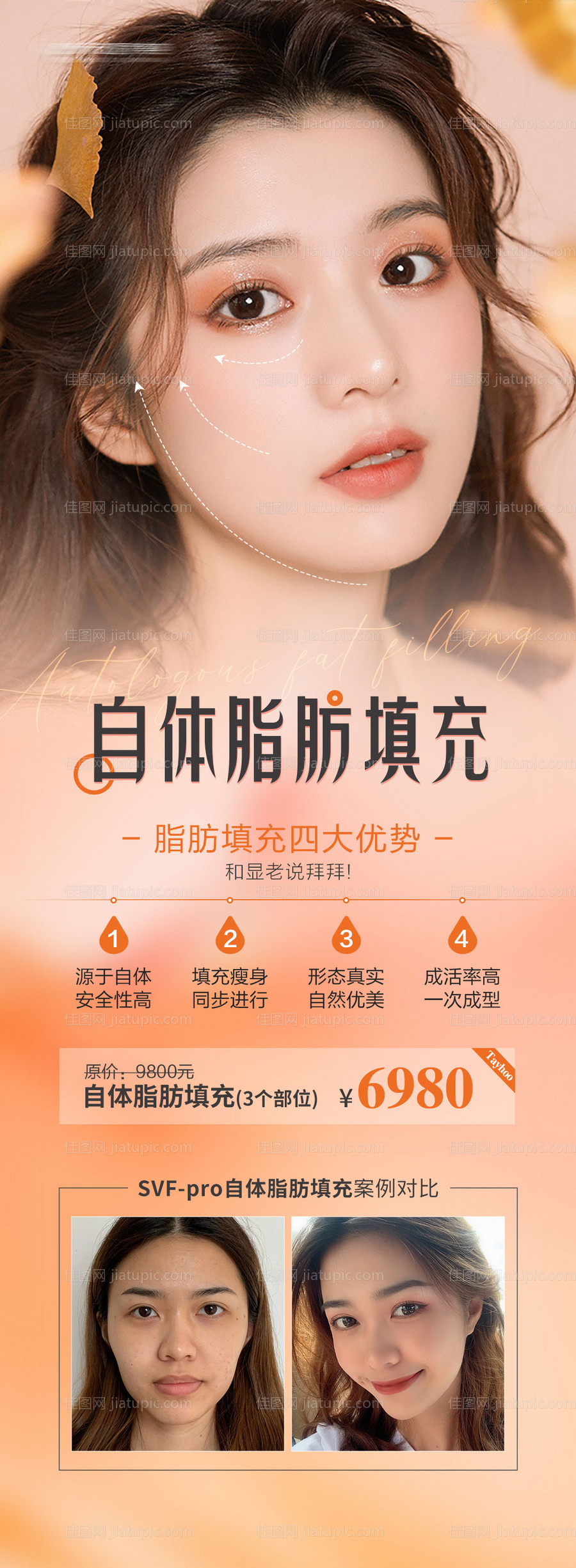 脂肪填充海报-源文件