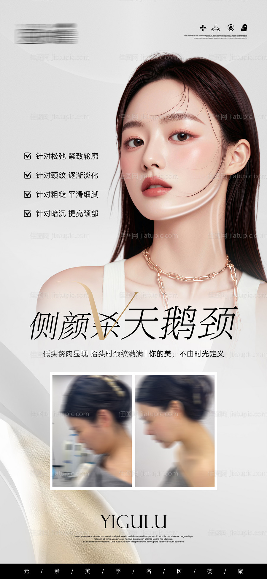 医美侧颜杀天鹅颈案例对比海报-源文件