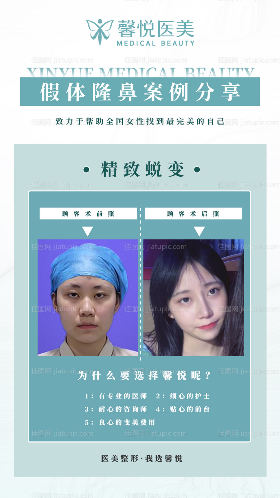 医美对比图-源文件