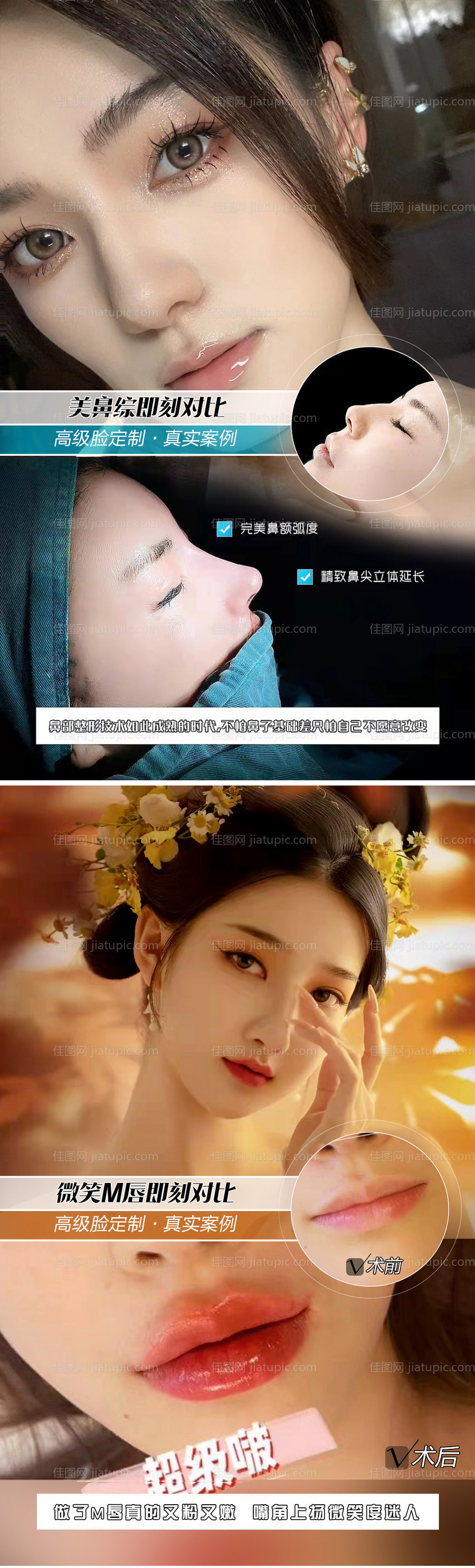 医美对比案例-源文件