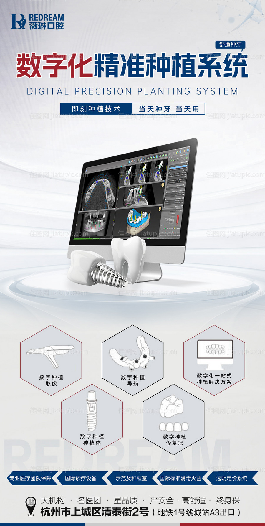 数字化精准种植-源文件