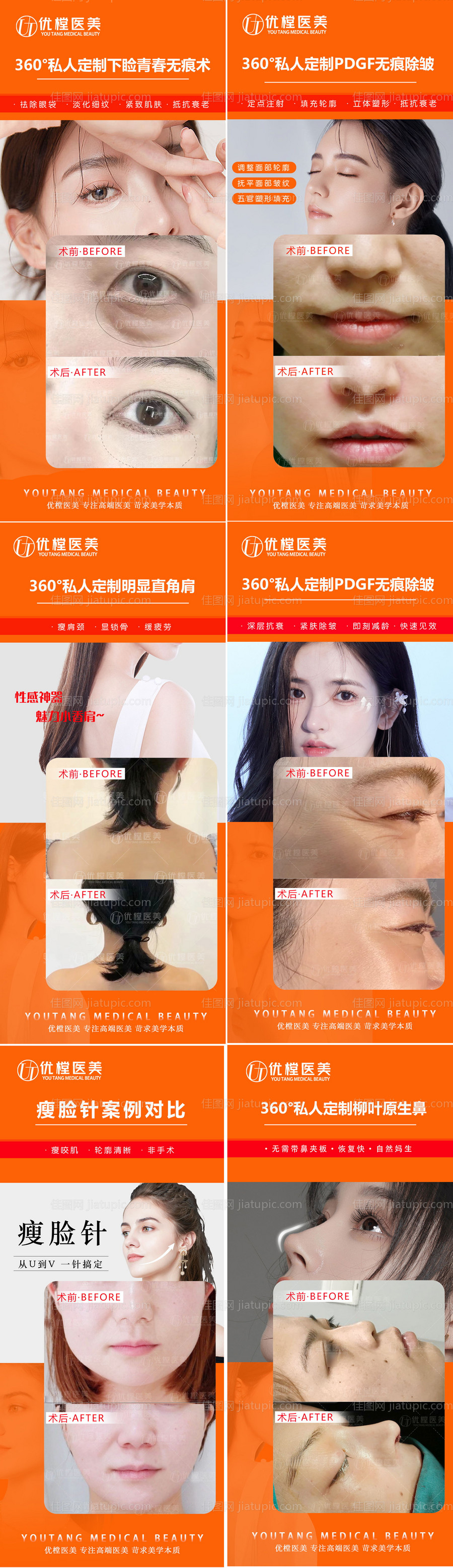 医美案例对比海报-源文件