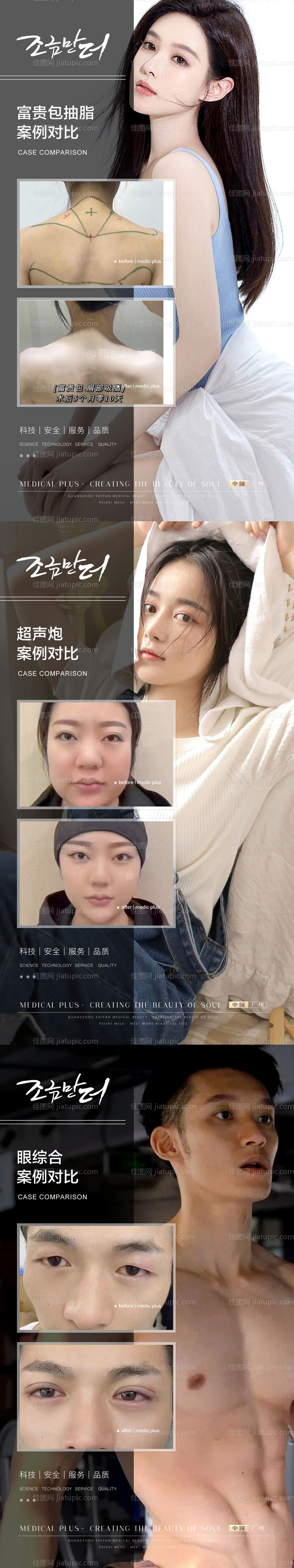 整形真人案例分享集海报-源文件