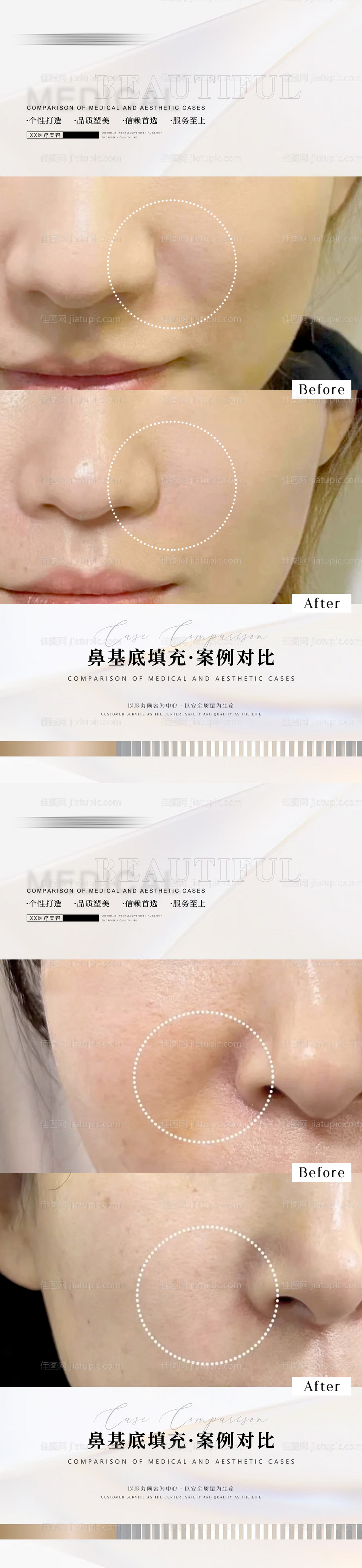 医美案例海报-源文件