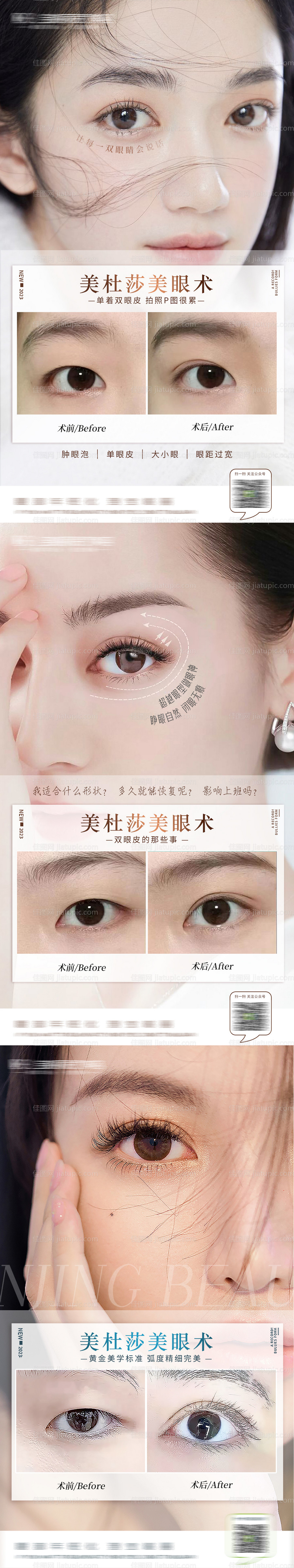 医美案例海报-源文件