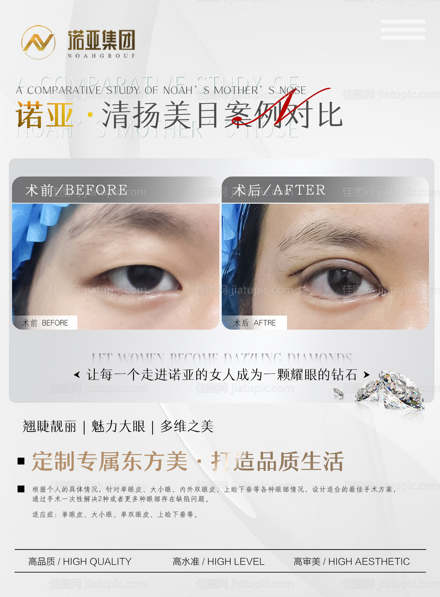 医美整形对比图-源文件