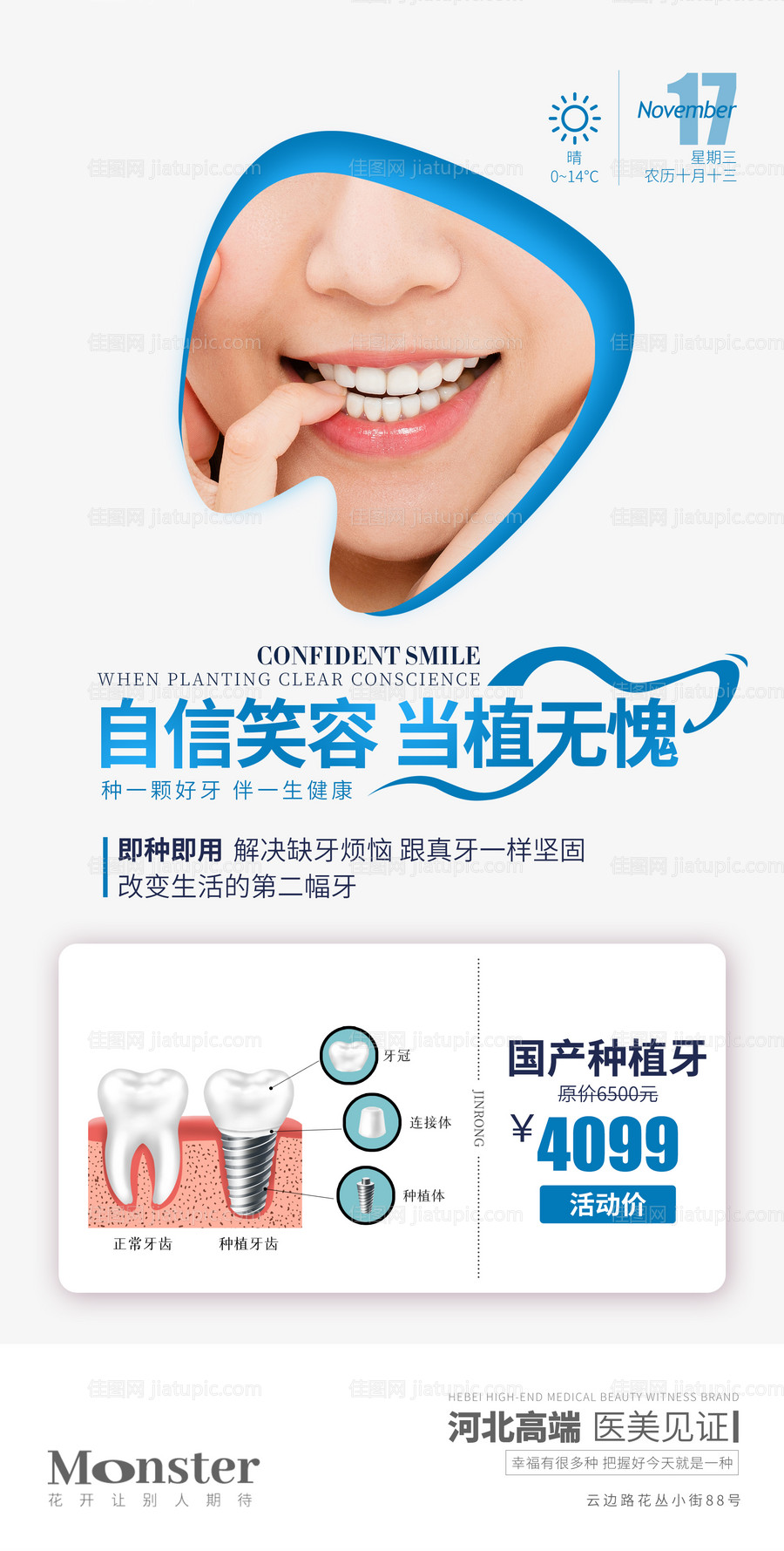 医美种植海报-源文件